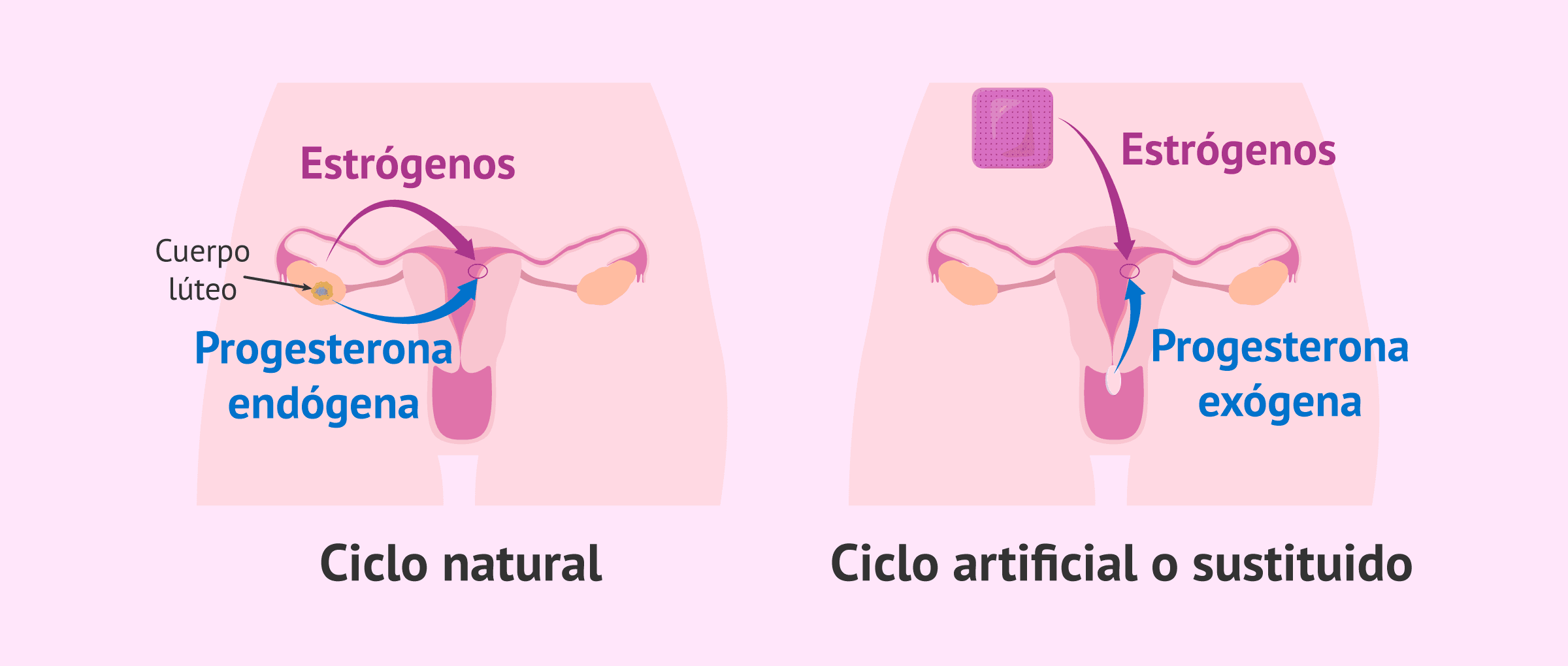 Imagen: Estrógenos y progesterona en ciclo natural y ciclo artificial
