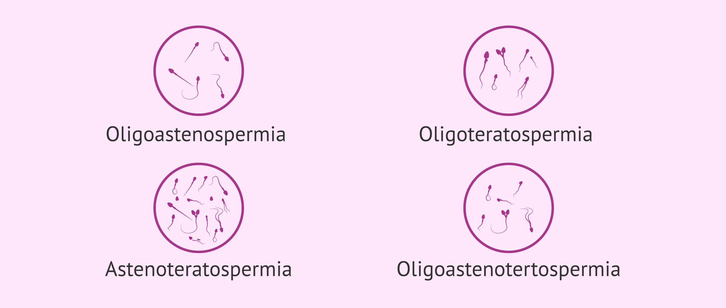 Imagen: Combinación de alteraciones seminales