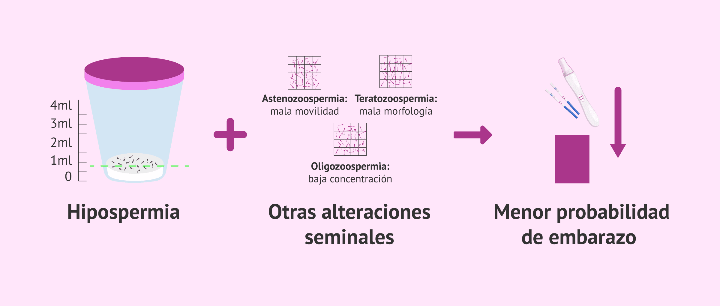 Imagen: Posibilidad de embarazo con hipospermia y otras alteraciones seminales
