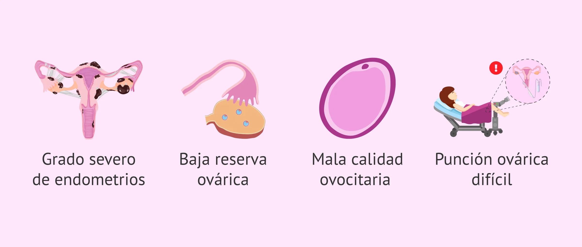 Imagen: Indicaciones de la ovodonación en mujeres con endometriosis