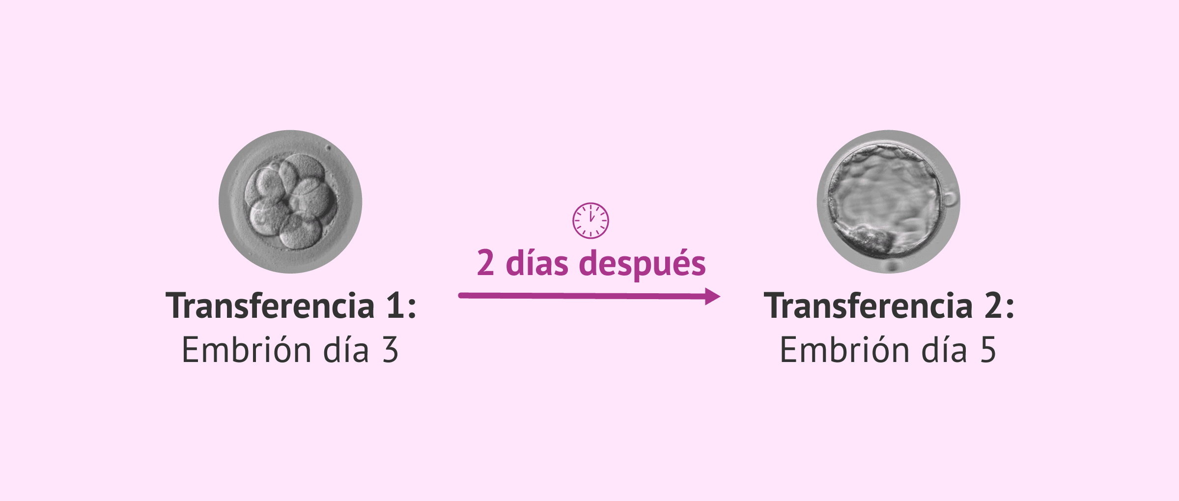 Imagen: Dos transferencias embrionarias en el mismo ciclo