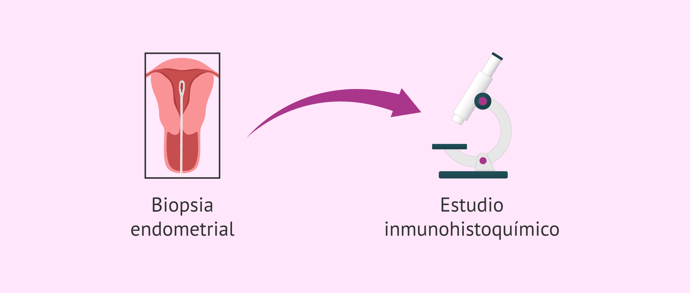 Imagen: Problemas para el diagnóstico de la endometritis crónica