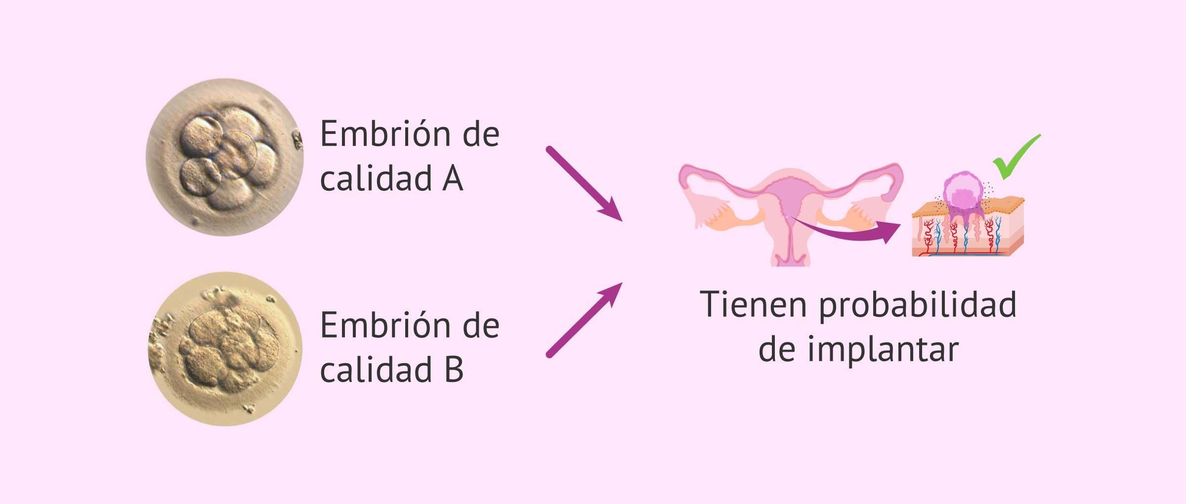 Imagen: Embrión de calidad A y B pueden implantar