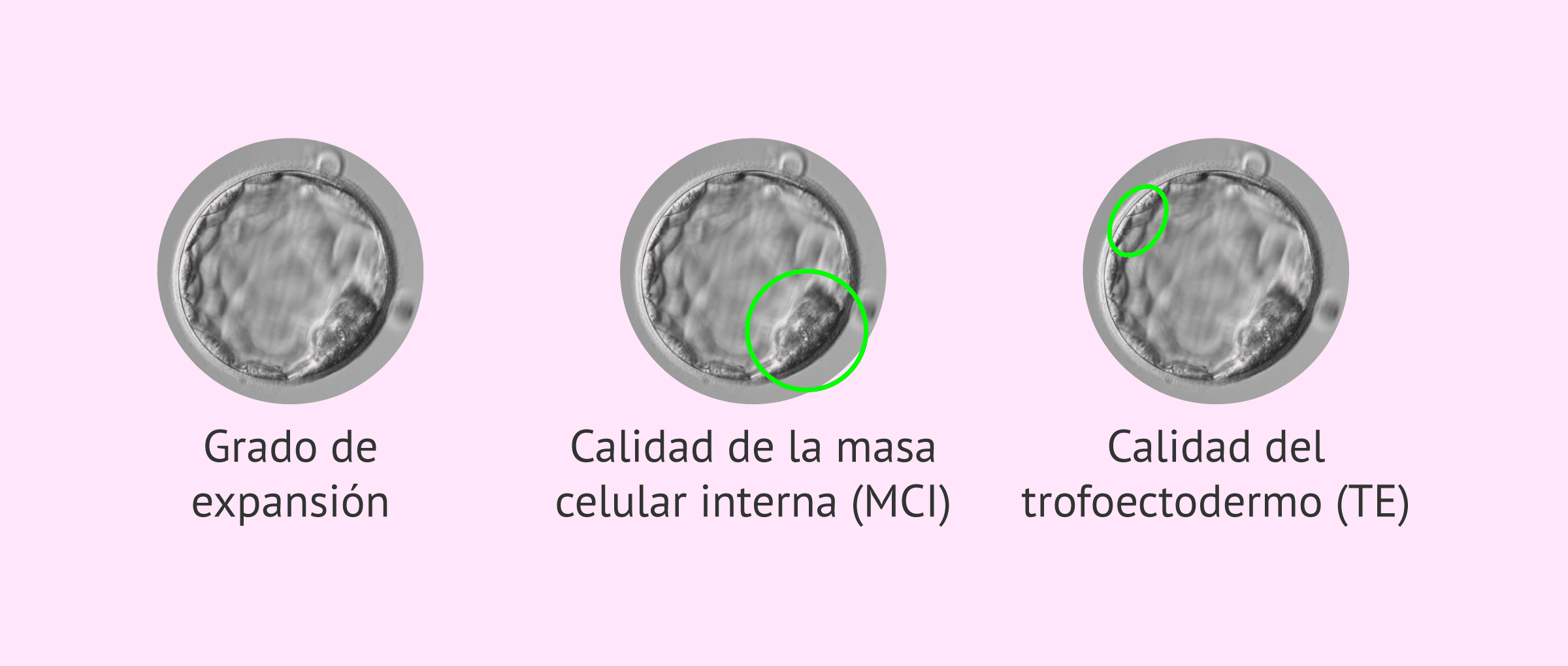 Imagen: Criterios para la clasificación de blastocistos