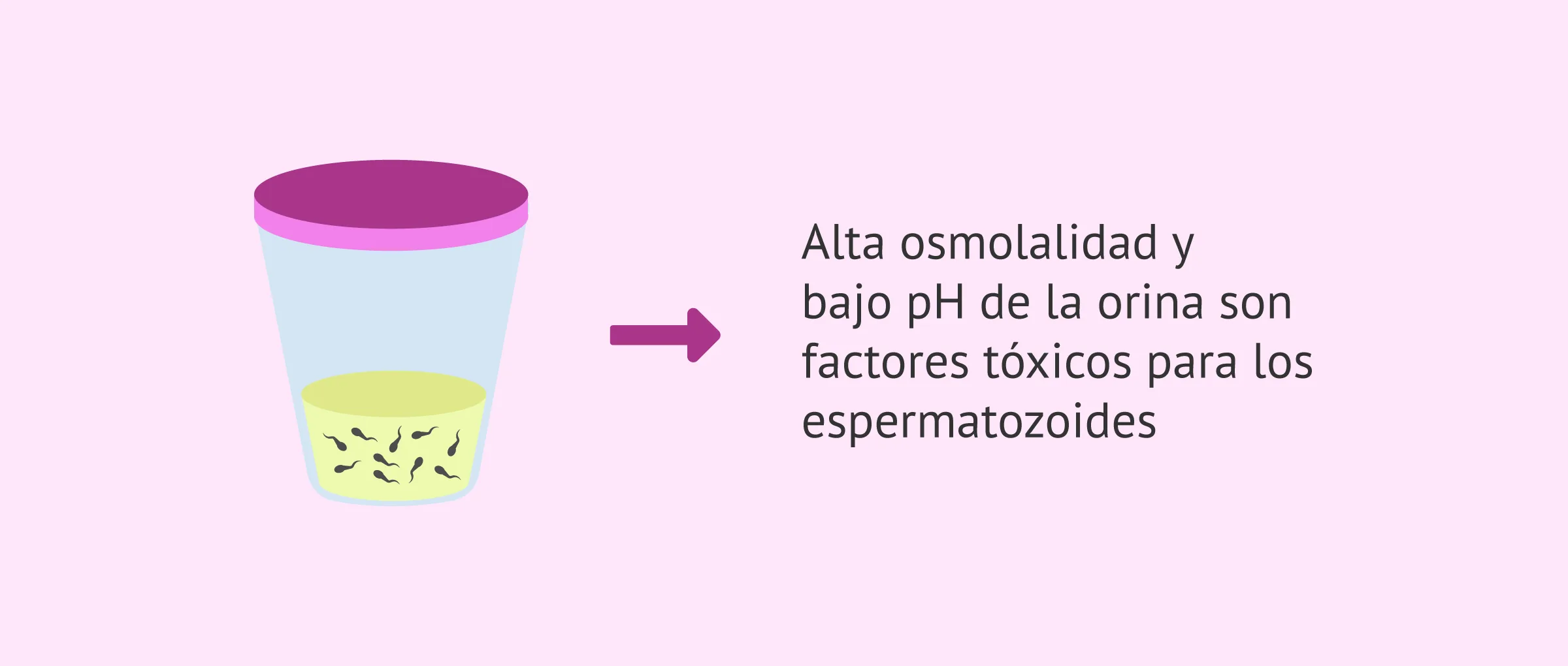Espermatozoides en orina tras eyaculación retrógrada